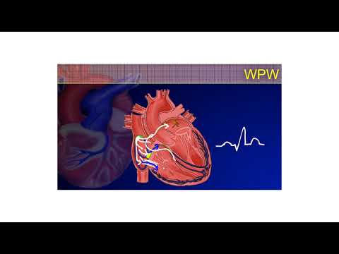 The 12-Lead ECG Course - 2b