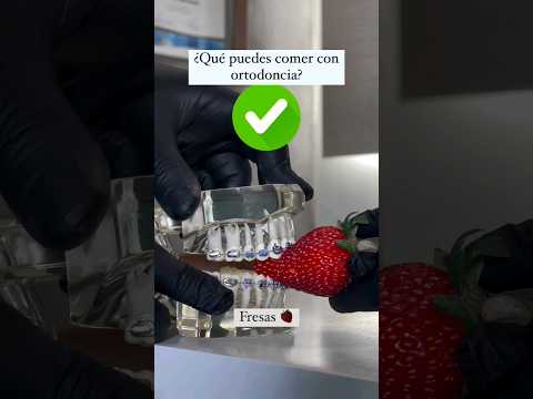 Alimentos que puedes comer con ortodoncia o #brackets #dentist #dentista #dental #dientes