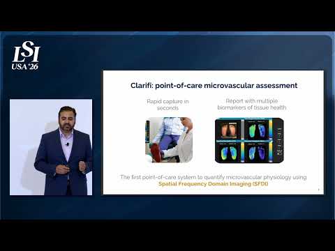 Amaan Mazhar, Modulim - Noninvasive imaging for tissue oxygen & blood | LSI USA '26