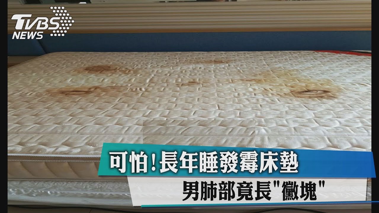 可怕! 長年睡發霉床墊 男肺部竟長「黴塊」