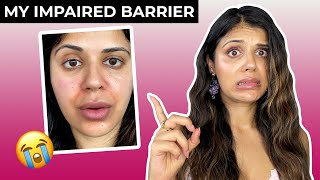 How I fixed my DESTROYED skin barrier in a week!