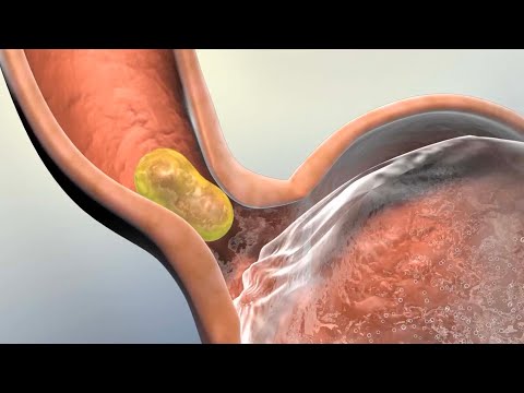 How Your Body Absorbs the Food You Eat