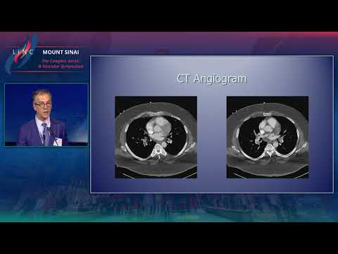 Diagnosis And Medical Management Of Acute Pulmonary Embolism