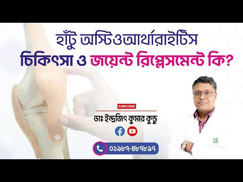 হাঁটু অস্টিওআর্থারাইটিস চিকিৎসা ও জয়েন্ট রিপ্লেসমেন্ট কি? | Popular Diagnostic | পপুলার ডায়াগনস্টিক