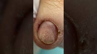 How To Grow SHORT BITTEN Nails ! Step by step