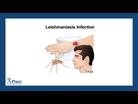 Leishmaniasis Infection