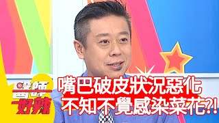 嘴巴破皮狀況惡化，不知不覺感染菜花？！【#醫師好辣】20201209 part4 EP1064 賈蔚 費丹尼
