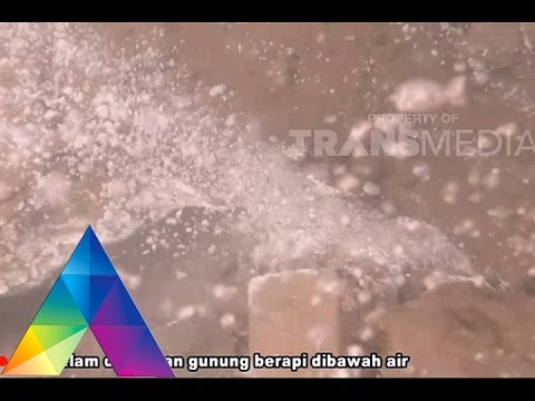 DR OZ INDONESIA 12 DES 2015 - Spesial Aceh Part 2/5