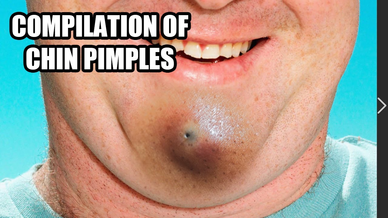 YouTube Thumbnail Downloader FULL HQ IMAGE