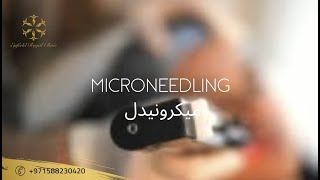 Microneedling in Dubai | RF Microneedling | Price & Offers | Dynamic Clinic