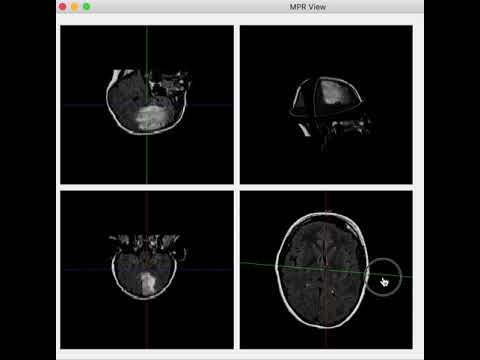 保健学科 MPR View For Mac OSX