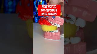 Download lagu How NOT to eat CUPCAKES with BRACES *what to do instead #braces #cupcakes #crunchy mp3 Download lagu How NOT to eat CUPCAKES with BRACES *what to do instead #braces #cupcakes #crunchy mp3