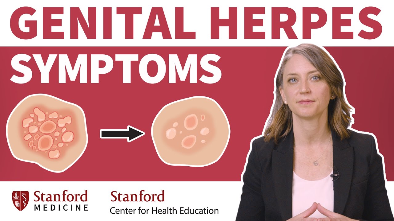 Uncovering the Truth about Genital Herpes: What You Need to Know, Beauty Vigour
