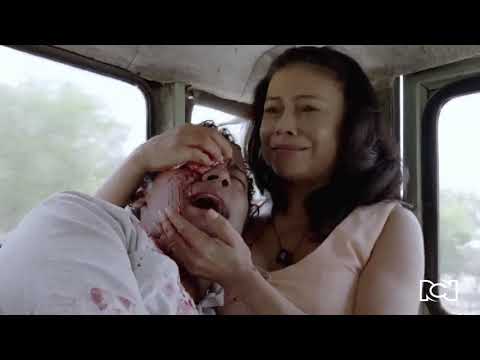 Diomedes sufre un fuerte golpe en su ojo derecho |  Diomedes, el Cacique de La Junta