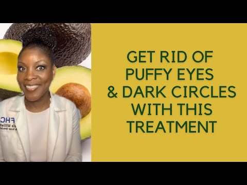 Get Rid of Puffy Eyes & Dark Circles With This Treatment | Avocado