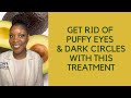 Get Rid Of Puffy Eyes Dark Circles With This Treatment Avocado