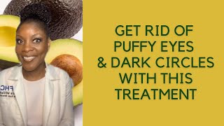Get Rid of Puffy Eyes & Dark Circles With This Treatment | Avocado