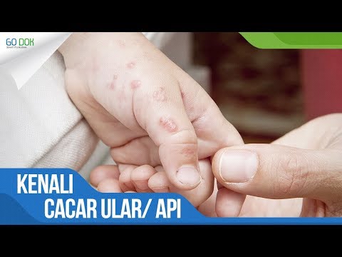 Aktivitas di bola gym untuk video penurunan berat badan Video latihan untuk menurunkan berat badan