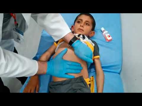 Examination of the Spleen -  Dr Ali Adel - Rapid Video