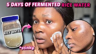 I used FERMENTED RICE WATER for 5 DAYS and this happened to my skin… #fermentedricewater