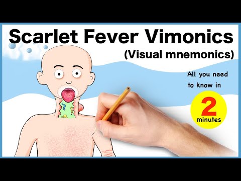 Scarlet fever Vimonics (Visual mnemonics): Important features