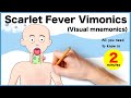 Scarlet Fever Vimonics Visual Mnemonics Important Features