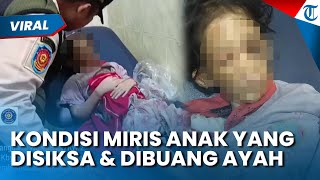 Kondisi Miris Anak yang Disiksa & Dibuang Ayah di Kebayoran Lama,  Patah Tulang Hingga Gizi Buruk