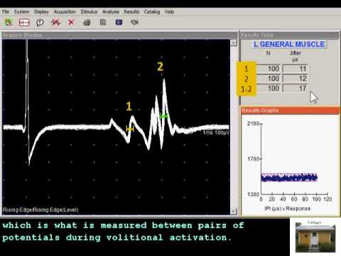 SFEMG - Voluntary vs Stimulated  (Don Sanders)