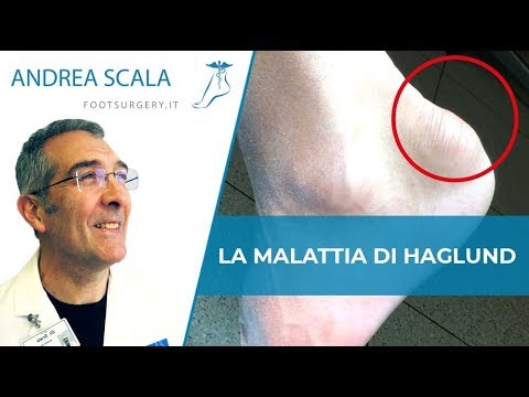 Dolore ovaio e posteriore destra Maznev malattia articolare