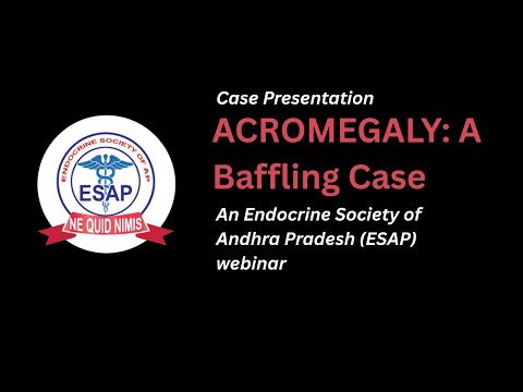 ESAP WEBINAR 1: CASE PRESENTATION:  An Interesting Case of Acromegaly