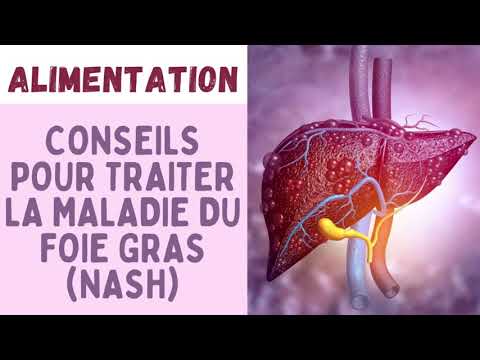 COMMENT TRAITER LA MALADIE DU FOIE GRAS / STÉATOSE HÉPATIQUE NON ALCOOLIQUE (NASH) 👩⚕️