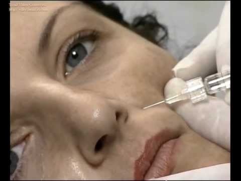 Osteocondrosi pugnala alla gola Komorowski displasia delle articolazioni dellanca Video