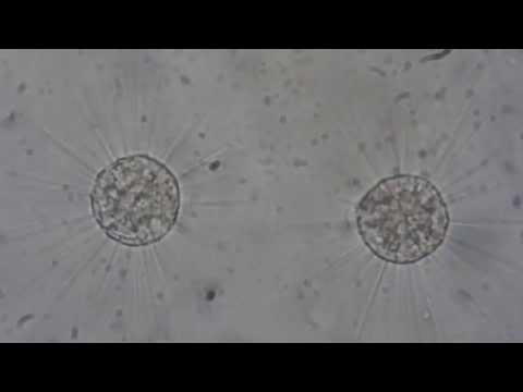 Actinophrys sol:  Time Lapse of protozoan binary fission