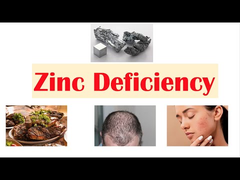 Zinc Deficiency | Dietary Sources, Causes, Signs & Symptoms (ex. Hair Loss), Diagnosis, Treatment