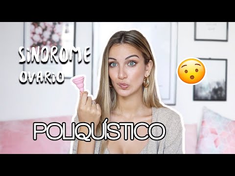 MI EXPERIENCIA CON SOP (Síndrome de ovario poliquístico) | STORYTIME