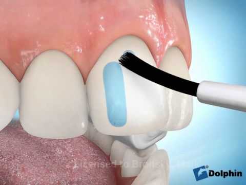 Conseil vidéo orthodontie