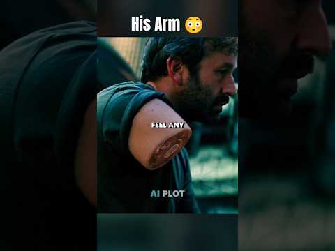 His Arm got Detached