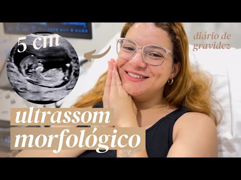 ULTRASSOM MORFOLÓGICO DO PRIMEIRO TRIMESTRE | 12 semanas de gravidez
