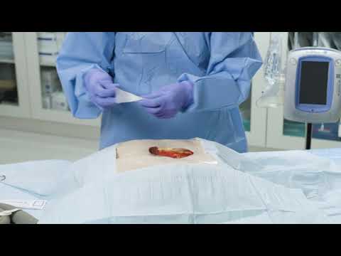 How to apply: 3M™ V.A.C. Veraflo Cleanse™ Dressing