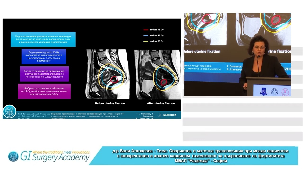 Ovarian and Uterine Transposition in Young Patients with Colorectal and Anal Cancer