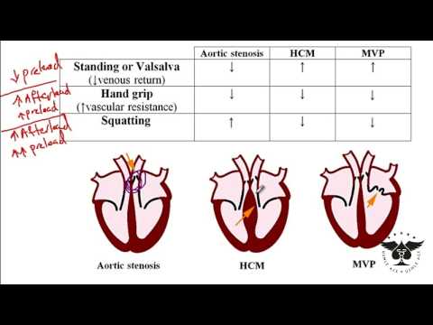 200 - Herzgeräusch, Aortenstenose, hyperthropische Kardiomyopathie usw. USMLE step 1 , ace