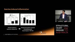 Atrial fibrillation in Athletes – Dr Adrian Elliott