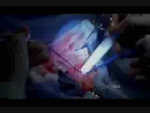 Katherine Heigl - Grey's Anatomy 5x19 Derek operates on Izzie