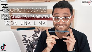 ¿Cómo podemos arreglarnos los dientes con una lima ¿Es tendencia en TikTok - Odontología Láser.