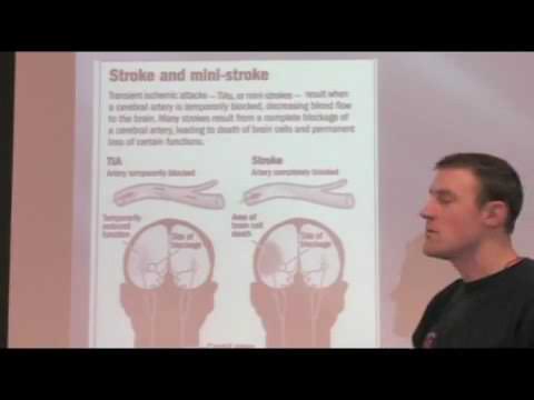 Was ist ein TIA-Schlaganfall?