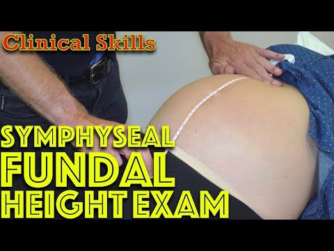 Pregnancy Check-up: Measuring Fundal Height (sfh) With Dr. Gill