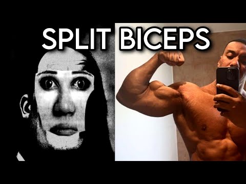 BICEP GENETICS