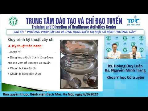 PHƯƠNG PHÁP CẤY CHỈ