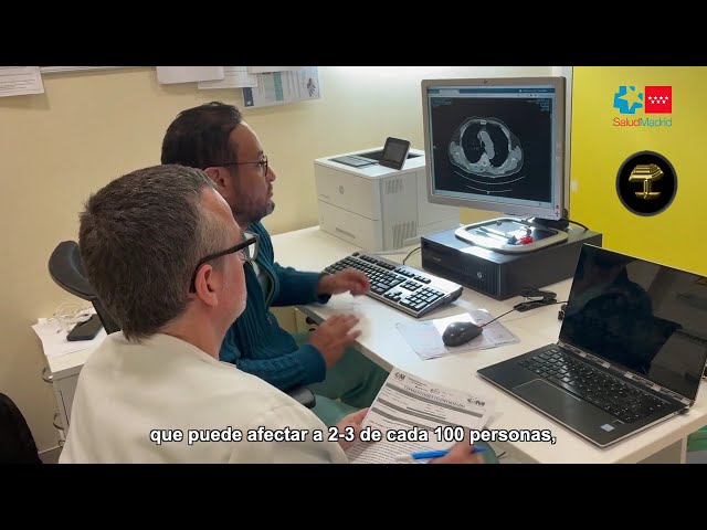 El Hospital público de Torrejón reduce el reingreso de pacientes con insuficiencia cardiaca