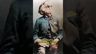 Historical Photos that you need to see 😱📸 The Elephant Man
